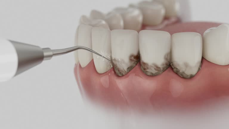 Reliable Tooth Extraction contractor in Spring Lake Park, MN by Smile Center Dentistry